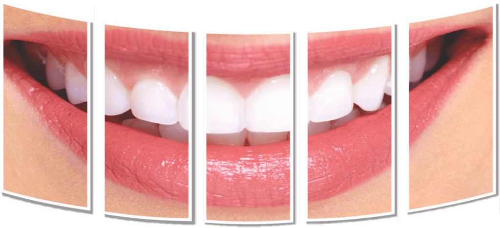 dental treatment in emi