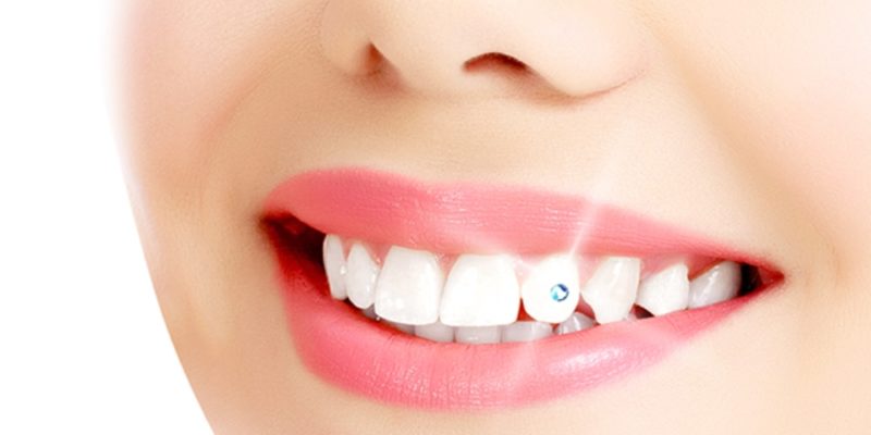 Tooth-Jewellery